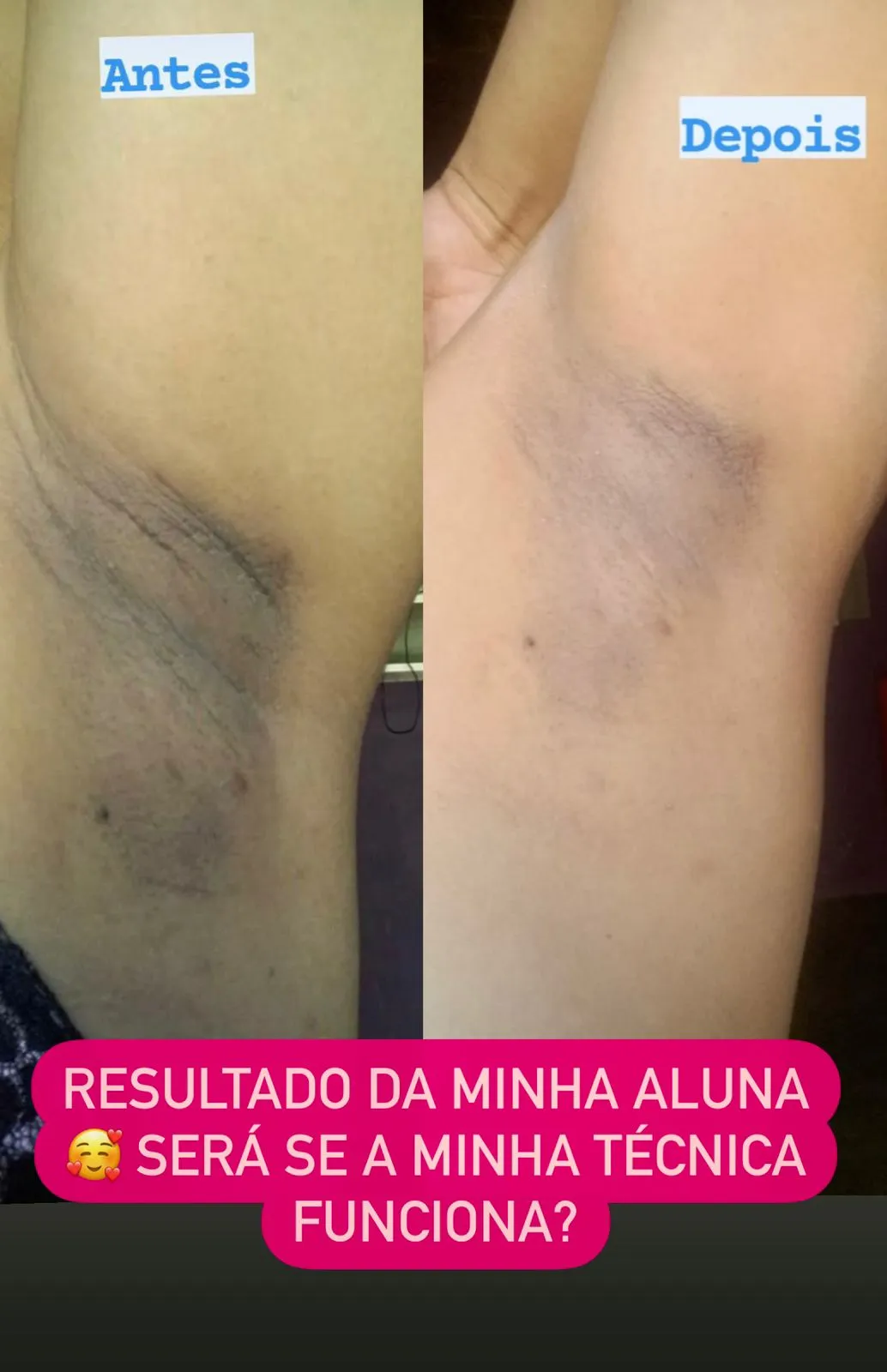DEPOIMENTO 01