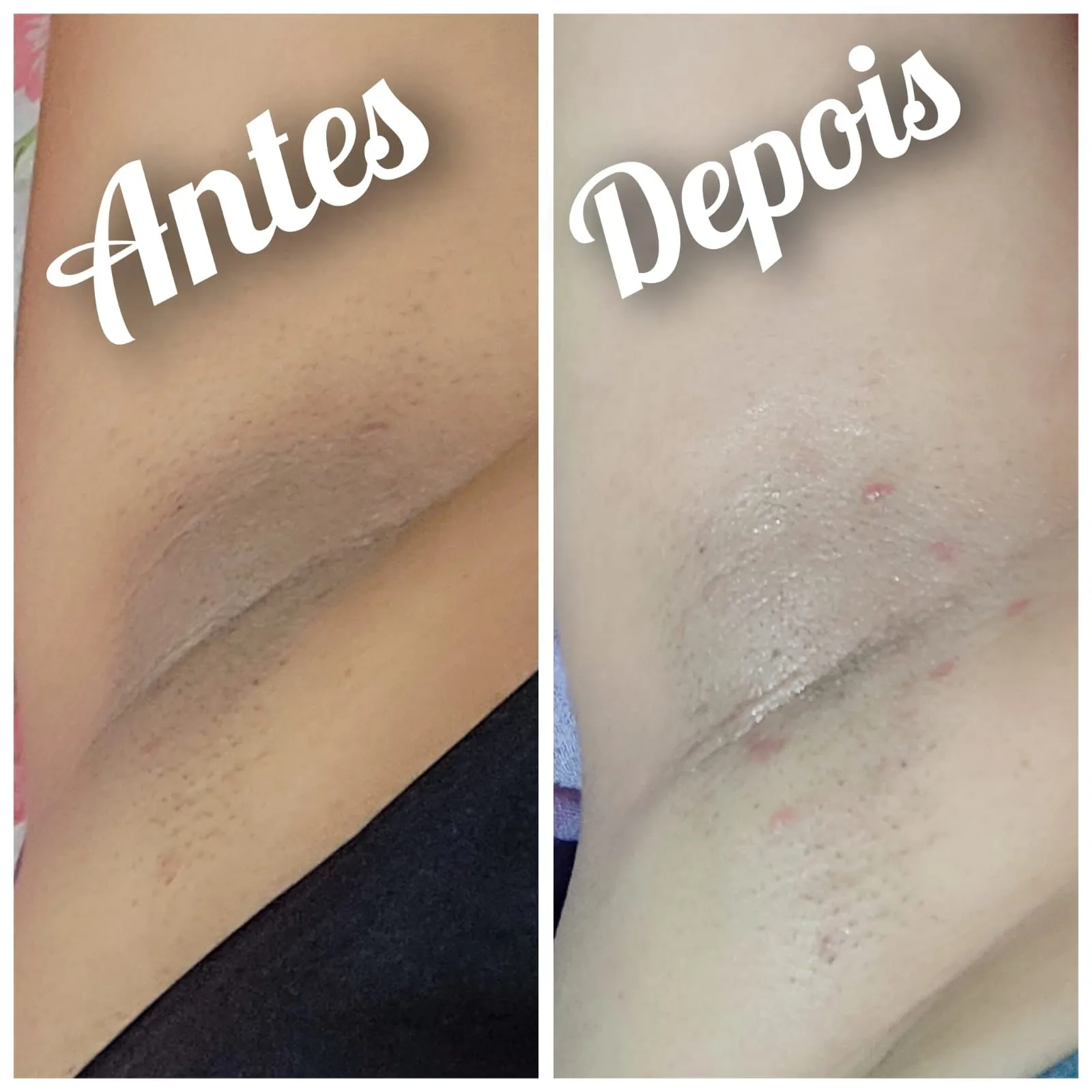 DEPOIMENTO 07