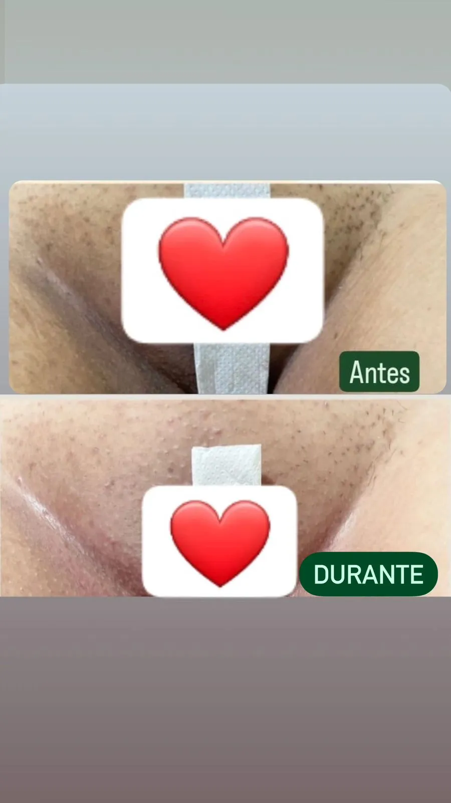 DEPOIMENTO 11