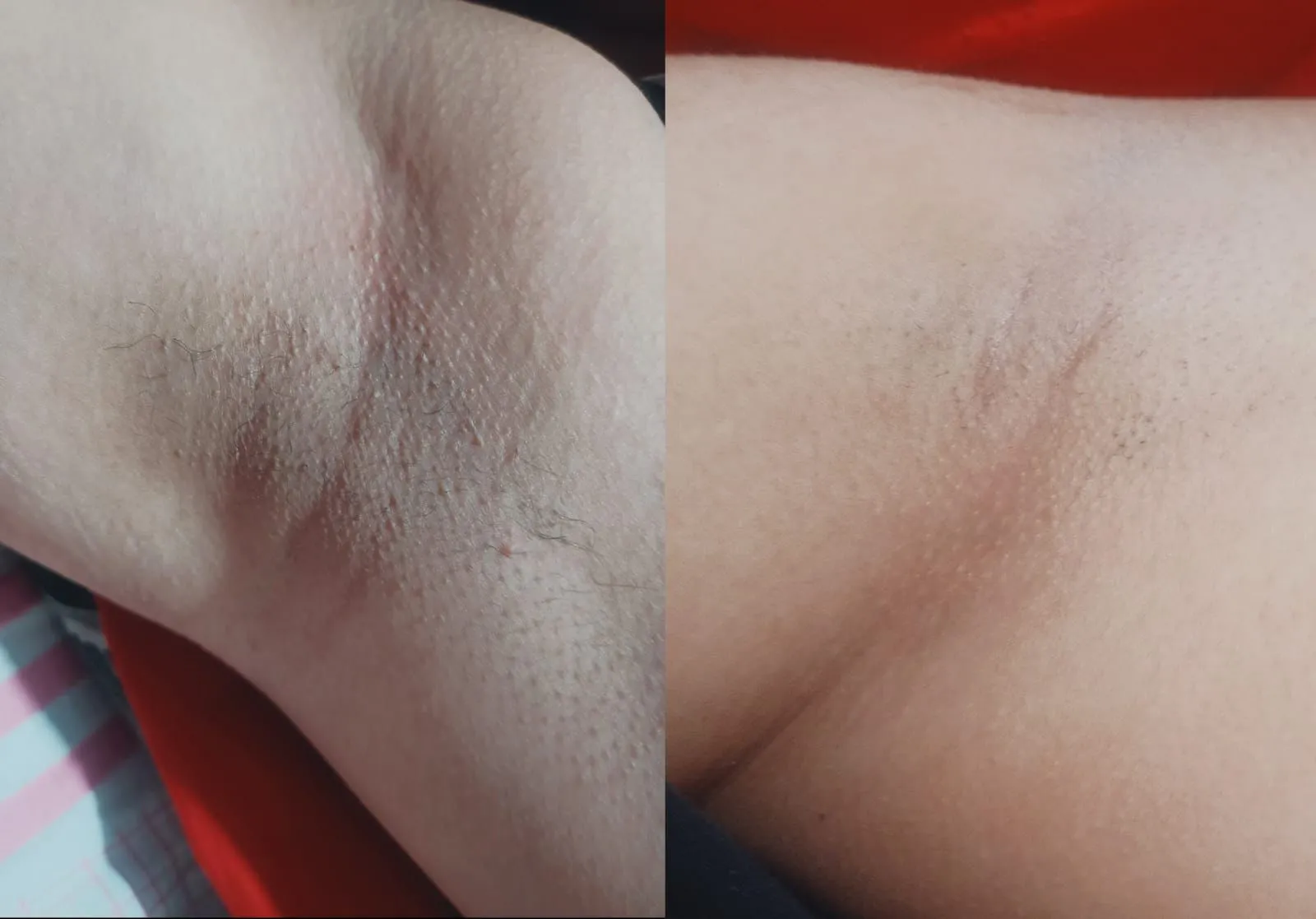 DEPOIMENTO-14