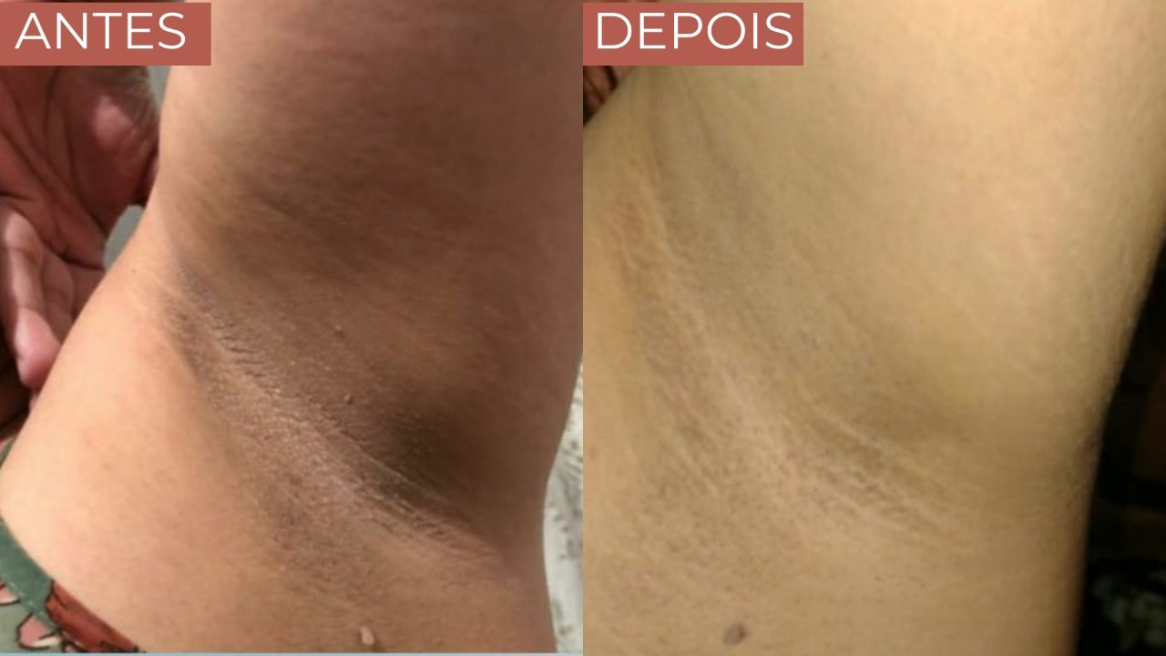 DEPOIMENTO-17