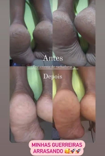 social04